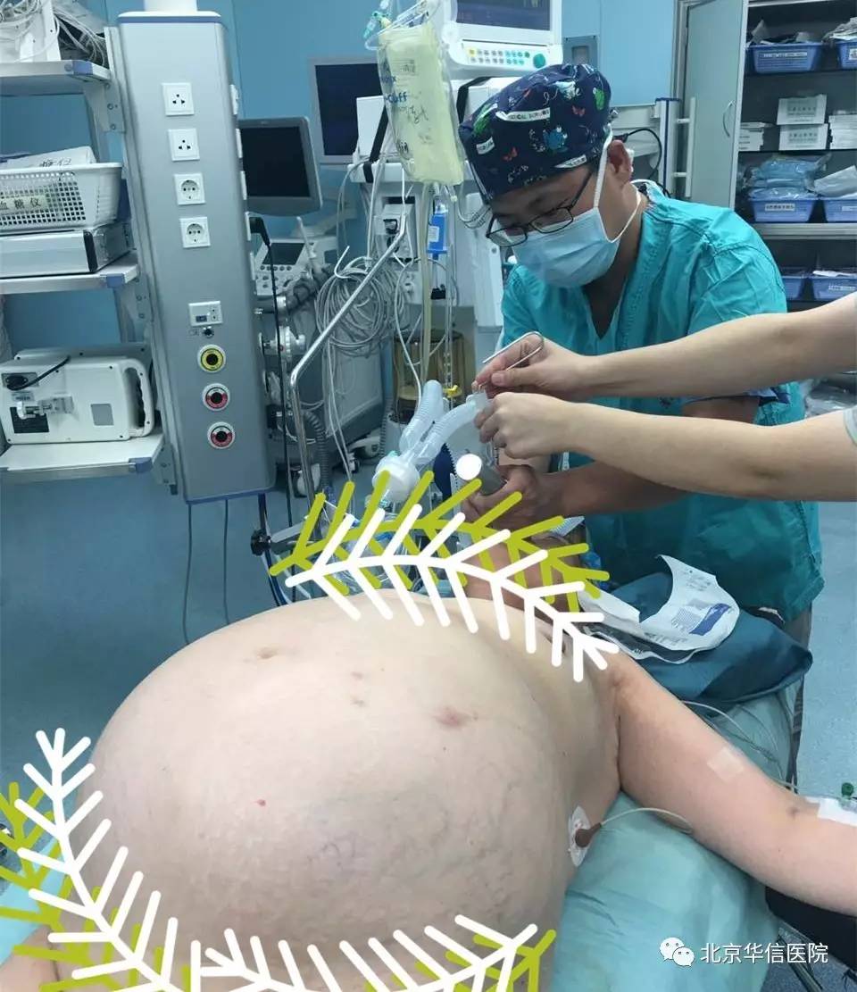 附件囊肿大于5cm一定要手术吗,附件囊肿手术是全麻还是局部麻醉