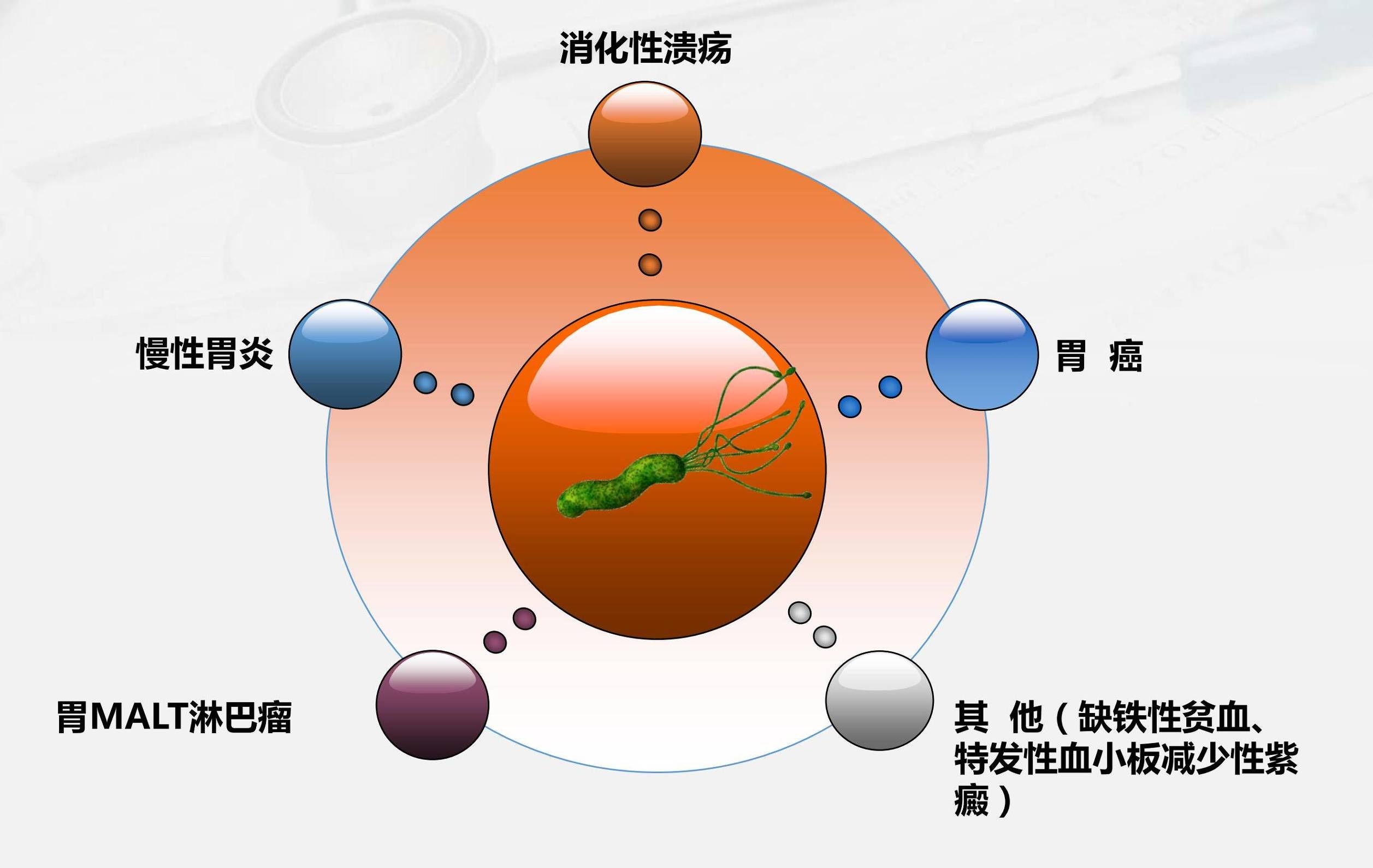 一半中国人都感染这种细菌,究竟要不要治?