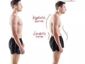 驼背矫正怎么练,驼背正确练法