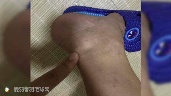每次打完羽毛球回家脚后跟酸痛,打羽毛球后左脚脚后跟和足弓疼