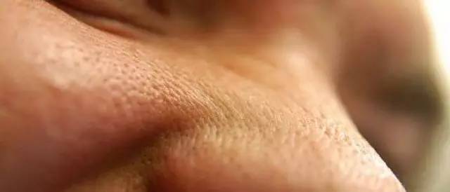 战痘｜史上最全”战痘“解答50+合集！