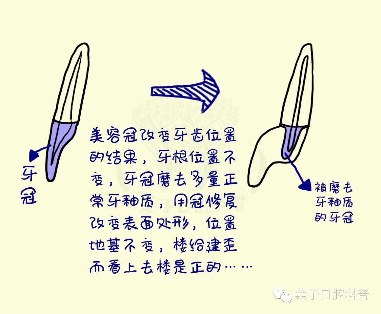 葉子口腔科普,口腔美容知识科普