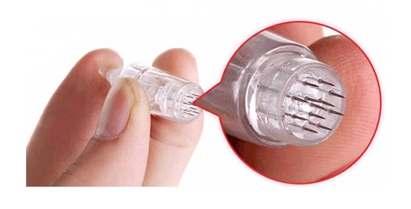 我的祛斑血泪史完整版,我的祛痘史