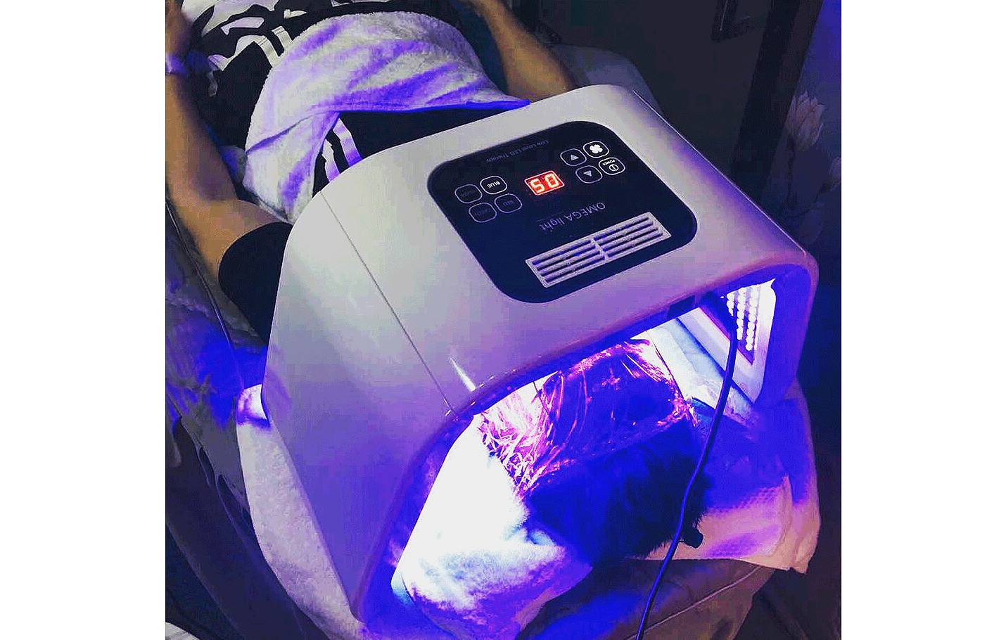 我的祛斑血泪史完整版,我的祛痘史