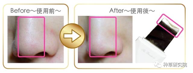 快速让皮肤变水嫩的方法,用鸡蛋怎么让皮肤水嫩嫩的