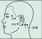 顽固性失眠，不妨试试针灸