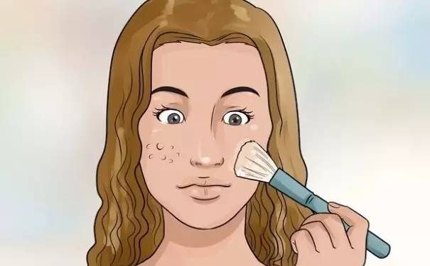 战痘｜史上最全”战痘“解答50+合集！