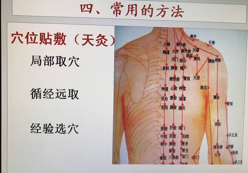 三伏贴能自制吗？孩子能贴吗？选择哪些穴位贴？贵医附院专家为你详细解答