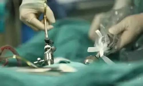腹腔镜手术用缝合吗,腹腔镜手术的利弊
