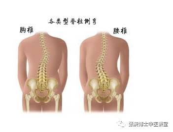 小针刀治疗脊柱侧弯,脊柱侧弯小针刀可以治愈吗