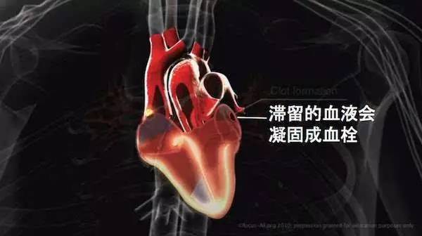 这种病诊断率低、死亡率高！惠州一住院总值准确判断挽救了患者的生命