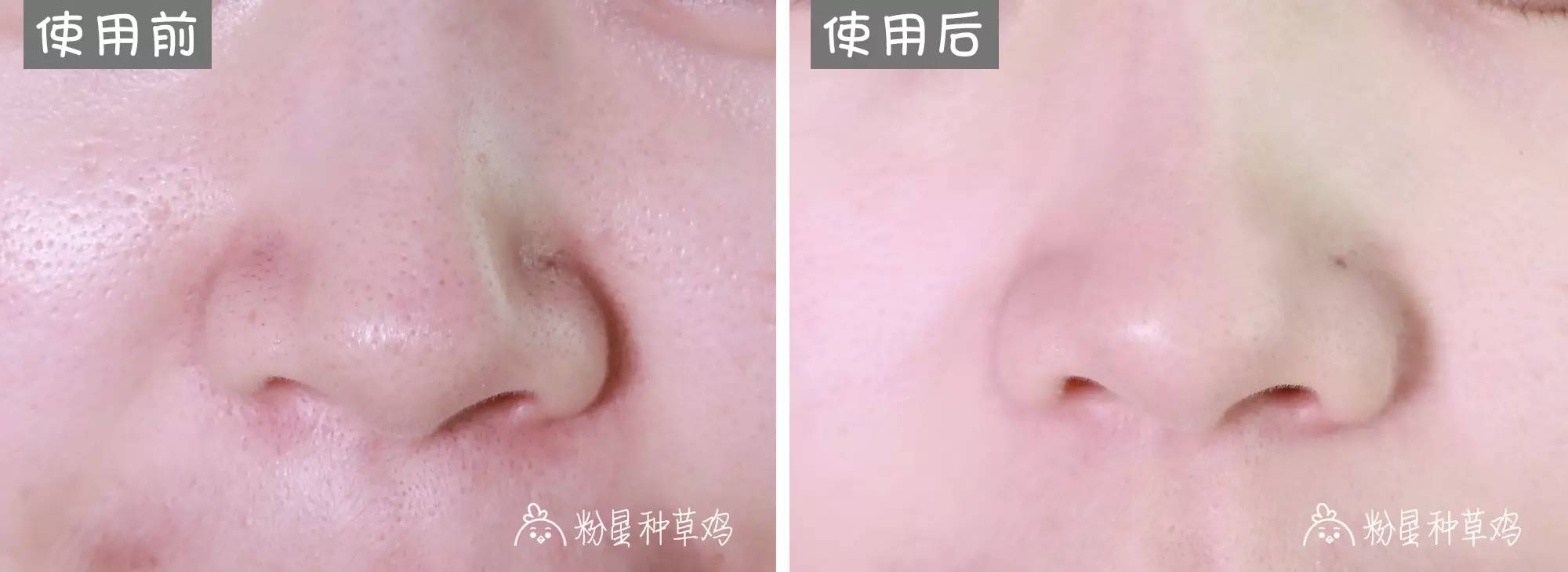 平价精华和面膜哪个好用,平价好用的清洁面膜求推荐