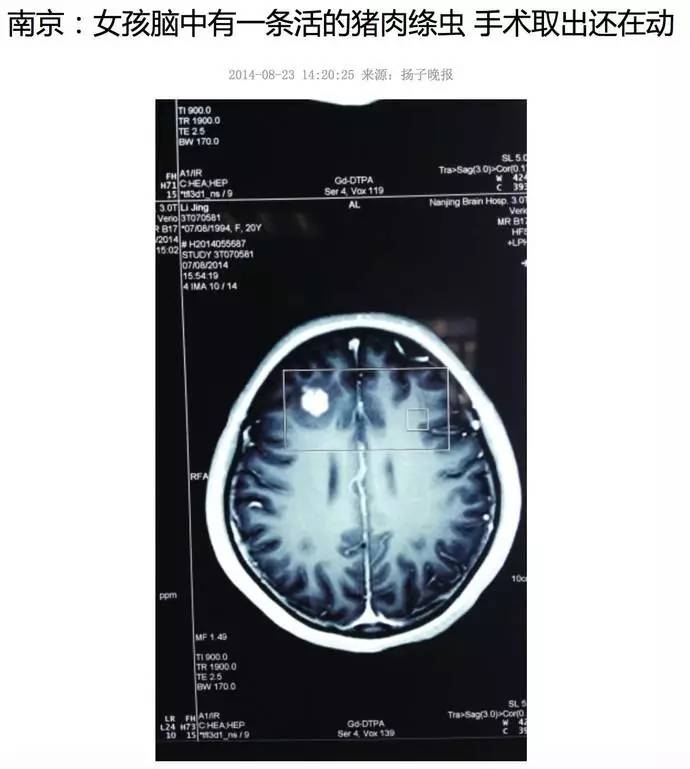 今朝上海｜永和大王、喜来稀肉相继被揭黑料，菜虫、疑似寄生虫横躺美食间，没想到网友的看法却截然相反！