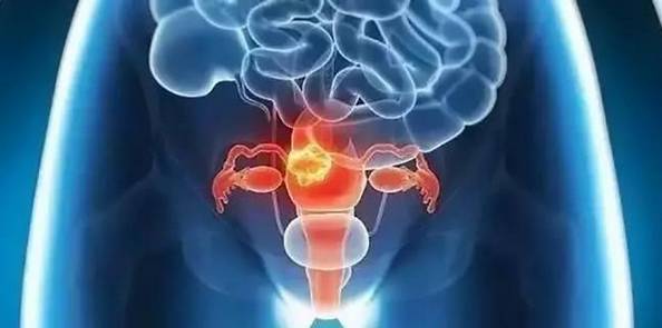 癌症疫苗何时问世,女性癌症疫苗9价多少钱