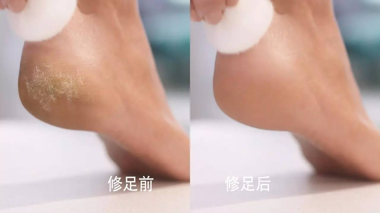 这⑥种神器没入手|你和你的夏天会过得很「粗糙」……