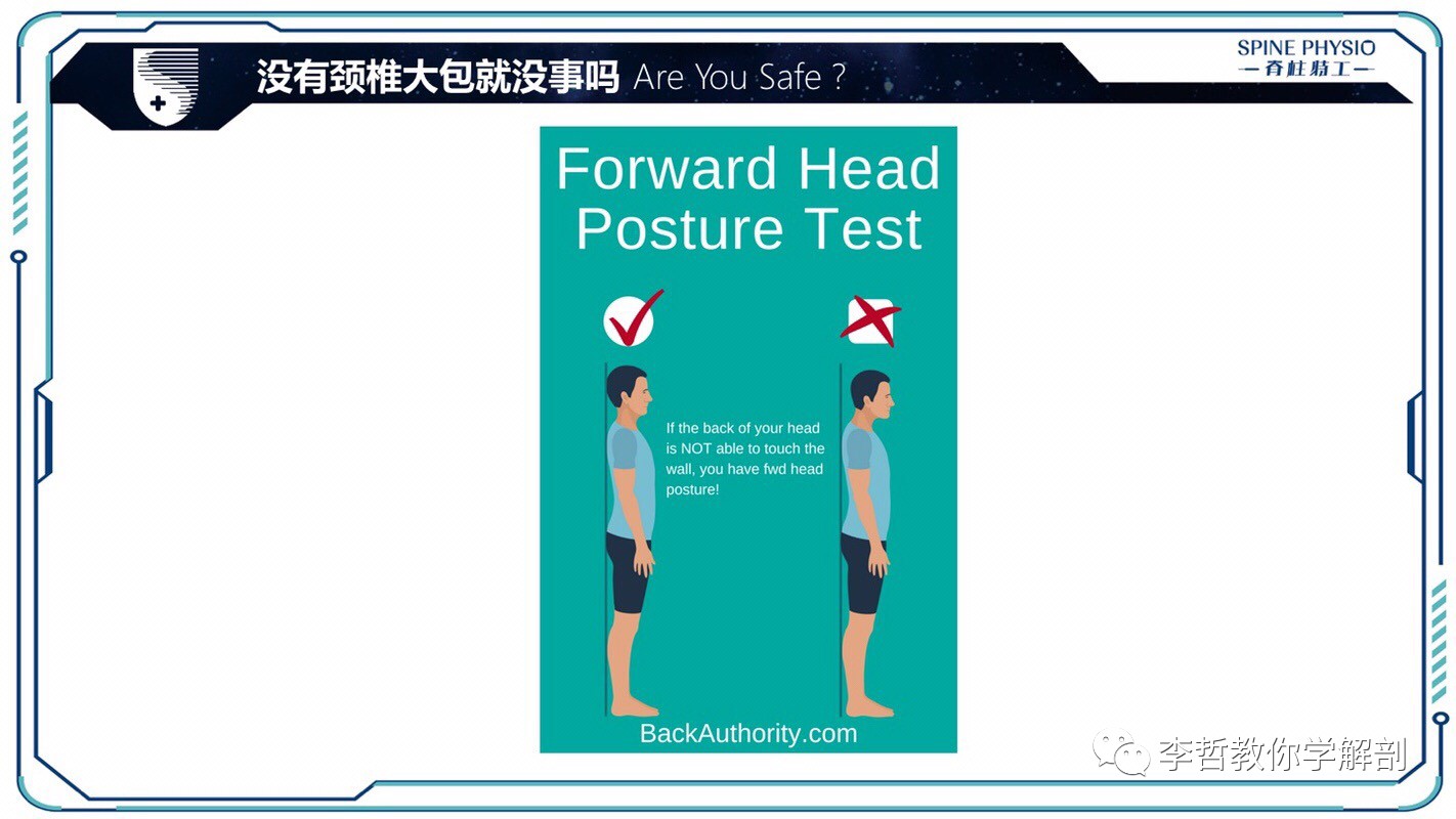 24度颈部大包怎么去除,颈后大包通过训练消除