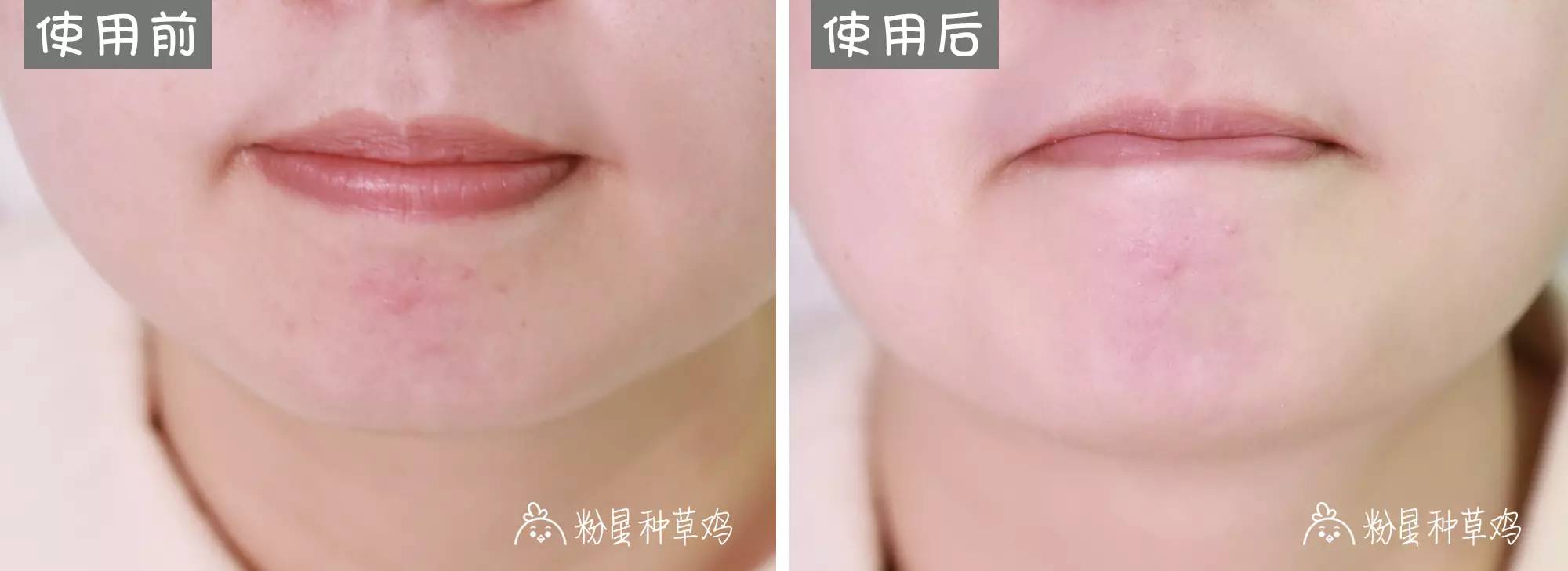 平价精华和面膜哪个好用,平价好用的清洁面膜求推荐