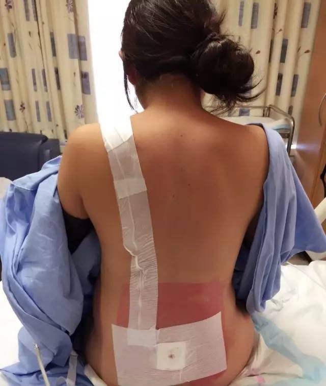 谁说生孩子一定要痛?你可以了解一下“无痛分娩”