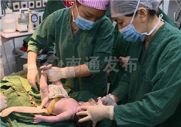 胎儿肠外露,胎儿膈疝需要开刀吗