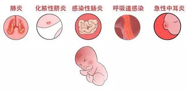 抗生素常见的使用的疑问和误区,抗生素常见误区图片