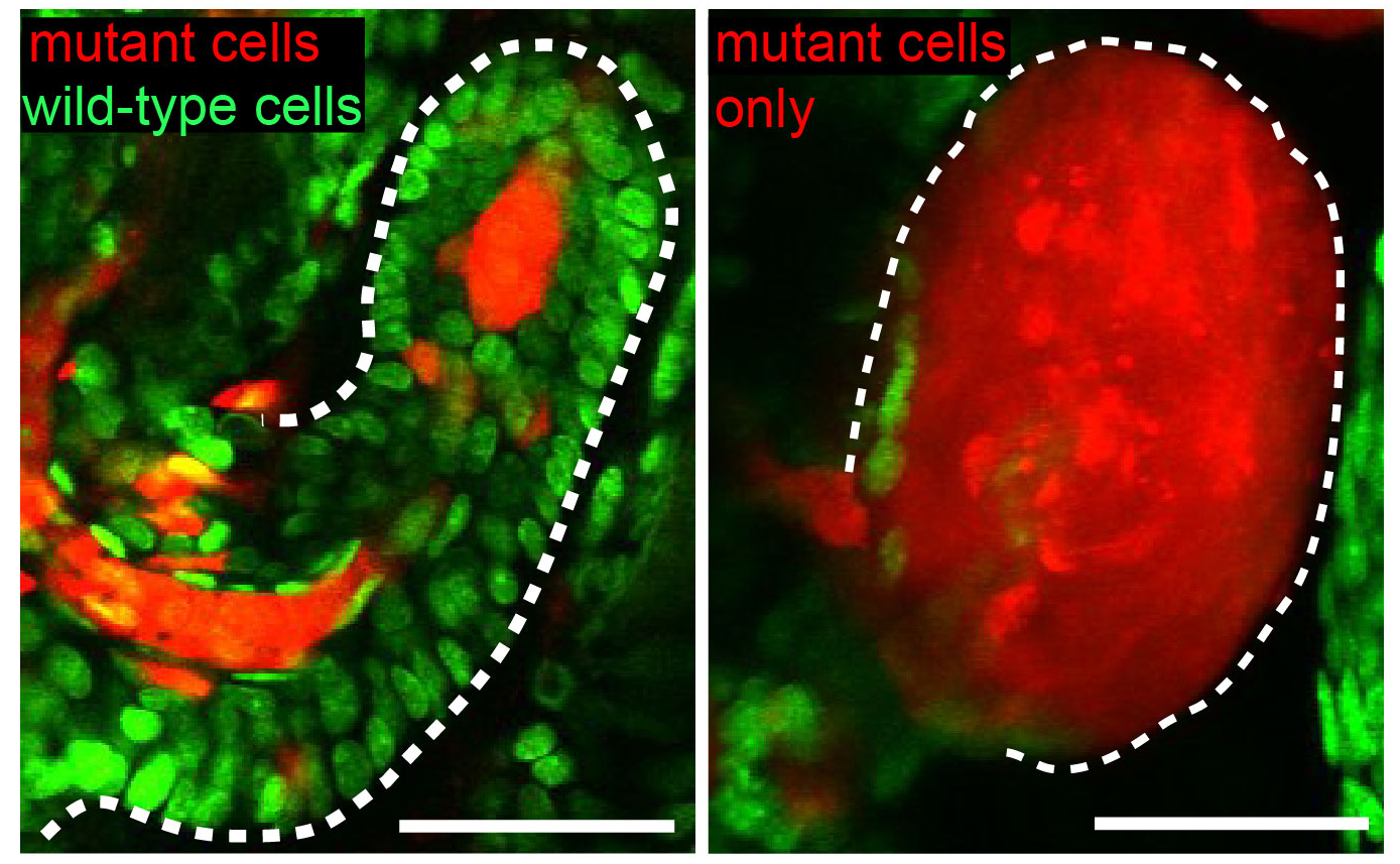 nature解码肿瘤免疫系统,nature真的能杀癌细胞吗