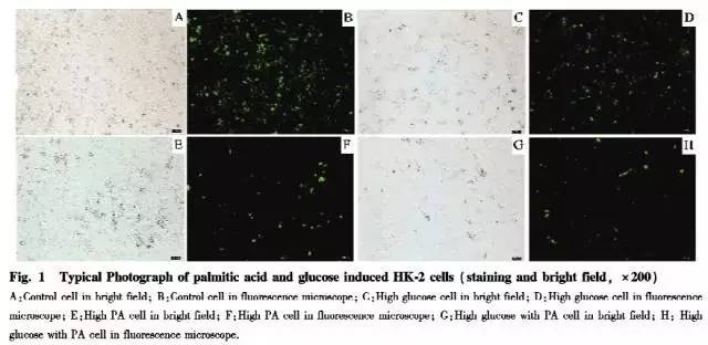 糖尿病肾病机制研究进展,糖尿病患者的代谢紊乱及其机制