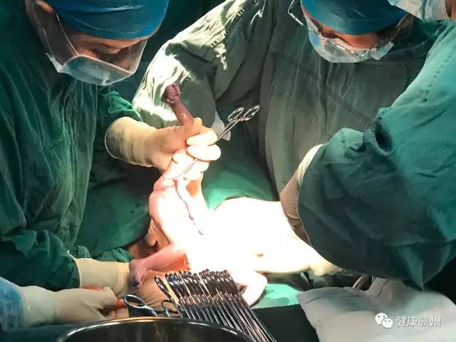 祝四胞胎心想事成,祝福双胎宝宝健康成长