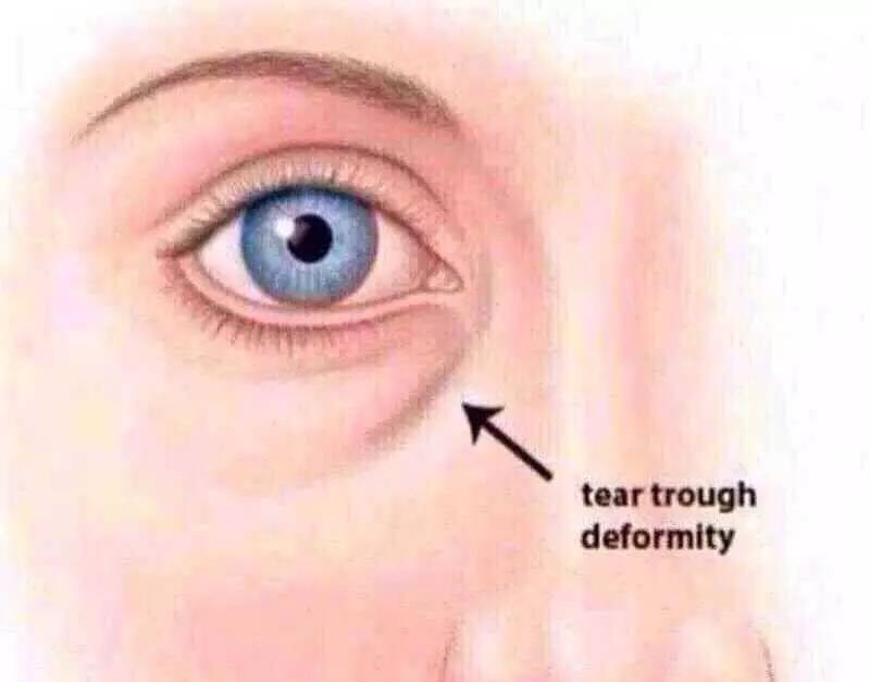 磨皮滤镜美白详解,肤质磨皮滤镜