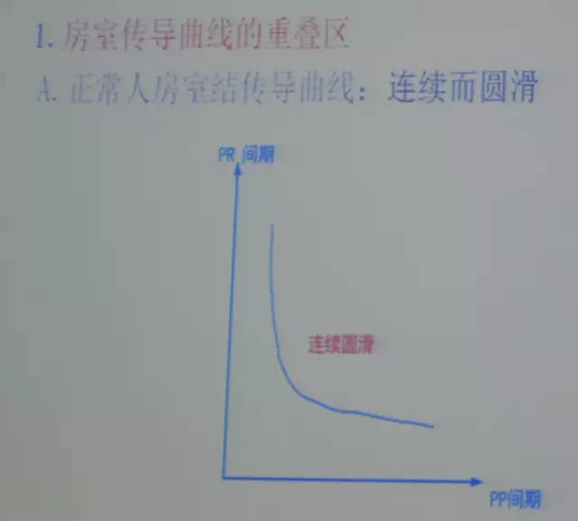 郭继鸿心电图学教程,郭继鸿异常心电图