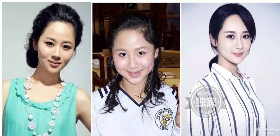 泪沟法令纹颈纹显老怎么办,改善泪沟法令纹全脸提升的方法