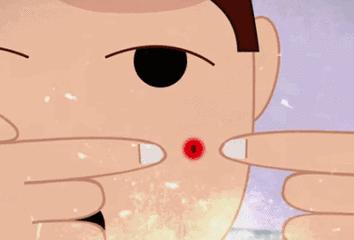 祛痘小窍门掌握了就不会有烦恼,最全祛痘攻略快速祛痘不留痕