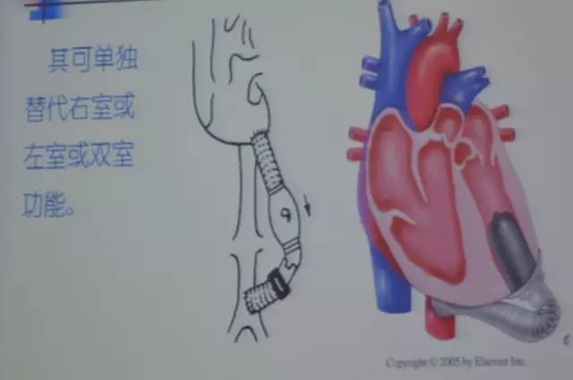 郭继鸿心电图学教程,郭继鸿异常心电图
