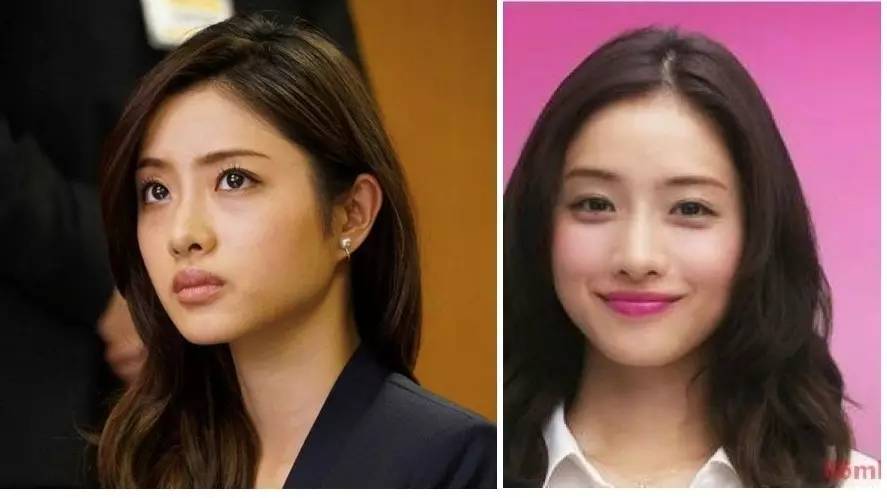 泪沟法令纹颈纹显老怎么办,改善泪沟法令纹全脸提升的方法