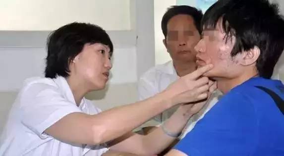 祛痘小窍门掌握了就不会有烦恼,最全祛痘攻略快速祛痘不留痕