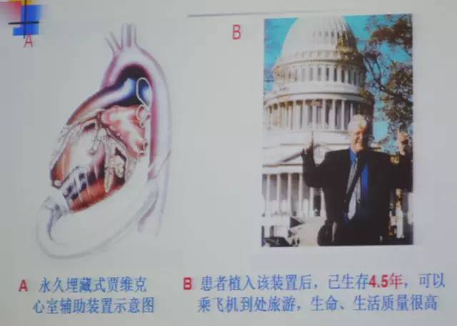郭继鸿心电图学教程,郭继鸿异常心电图