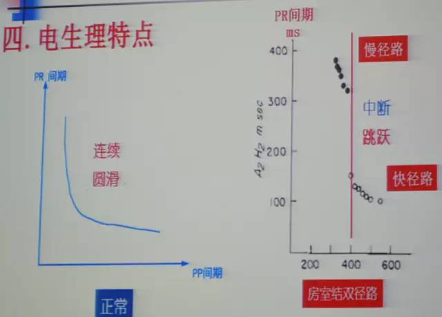 郭继鸿心电图学教程,郭继鸿异常心电图
