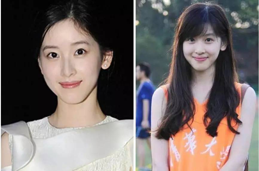 泪沟法令纹颈纹显老怎么办,改善泪沟法令纹全脸提升的方法