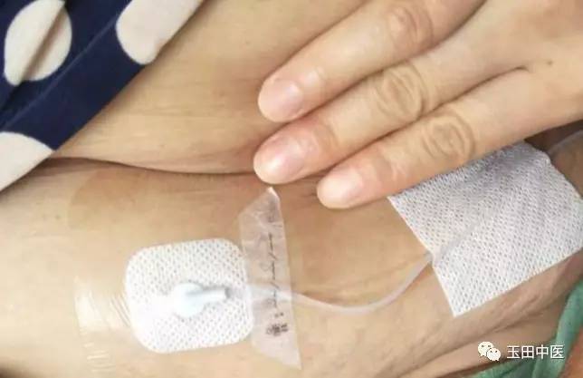 腰挂“BP机”，降糖真神奇！