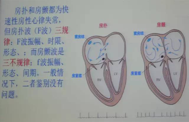 郭继鸿心电图学教程,郭继鸿异常心电图