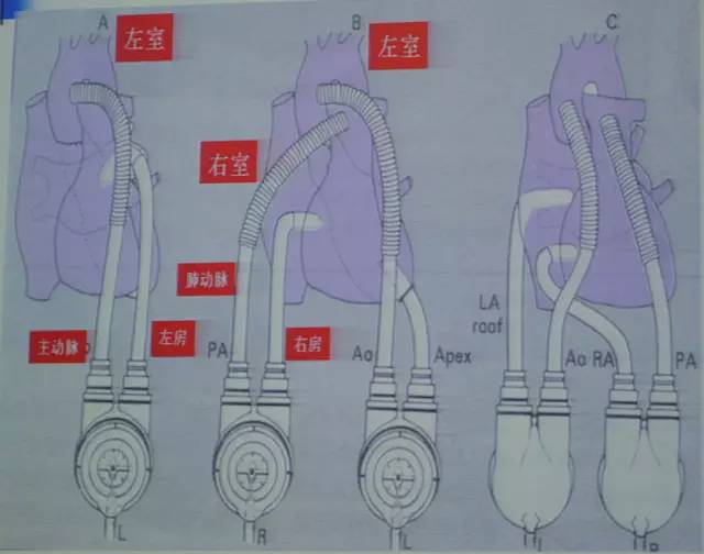 郭继鸿心电图学教程,郭继鸿异常心电图