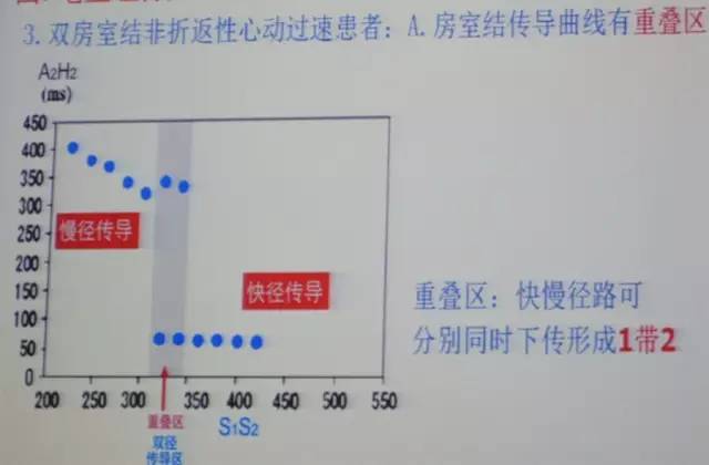 郭继鸿心电图学教程,郭继鸿异常心电图