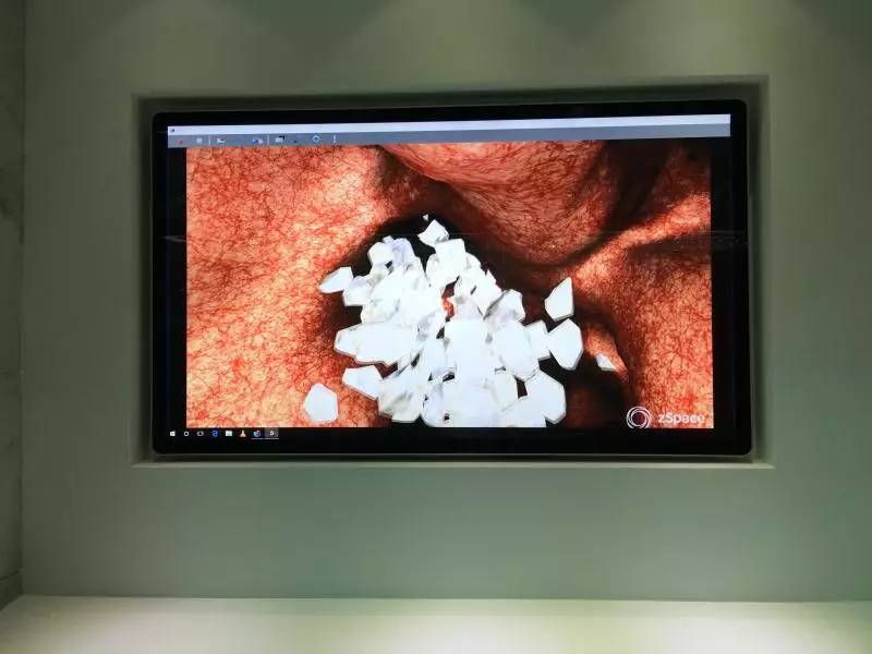 这个博物馆有点“疯狂”!2300份人体结石今天展出!就在东莞这个地方……