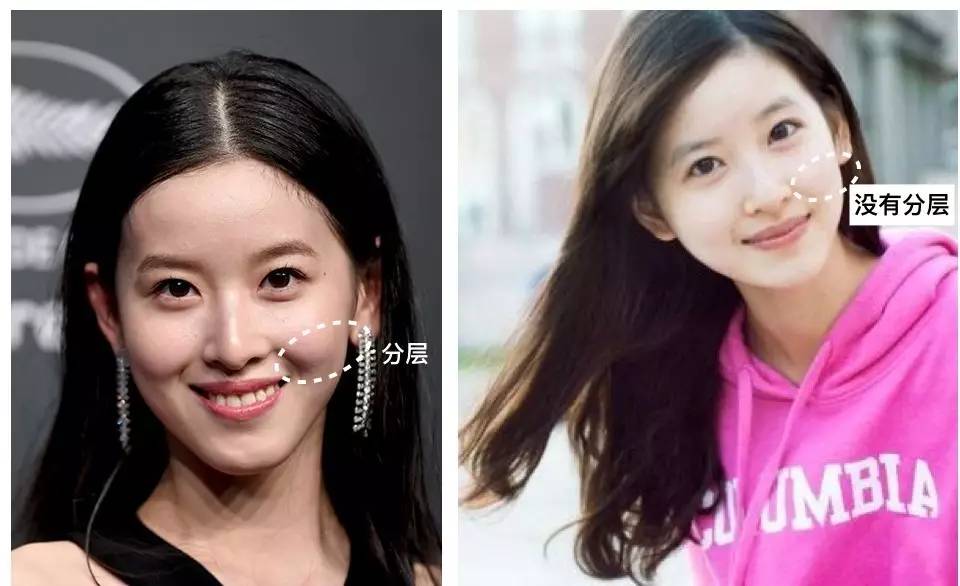 泪沟法令纹颈纹显老怎么办,改善泪沟法令纹全脸提升的方法