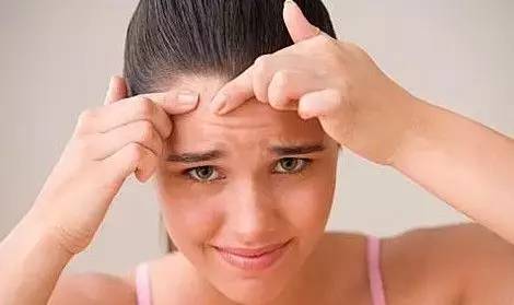 祛痘印用什么激光祛痘好,激光祛痘印痘坑能彻底去掉痘痘吗