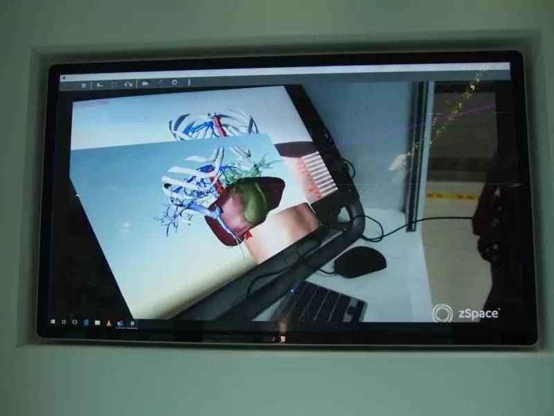 这个博物馆有点“疯狂”!2300份人体结石今天展出!就在东莞这个地方……