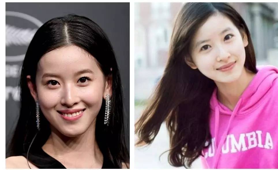 泪沟法令纹颈纹显老怎么办,改善泪沟法令纹全脸提升的方法