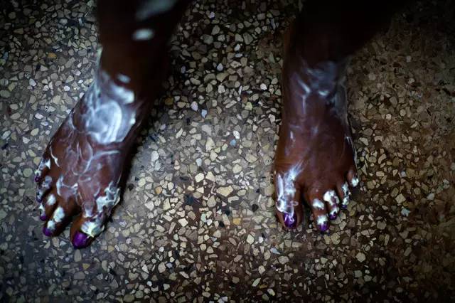 “我想变白，这样就会有更多男人来追我”