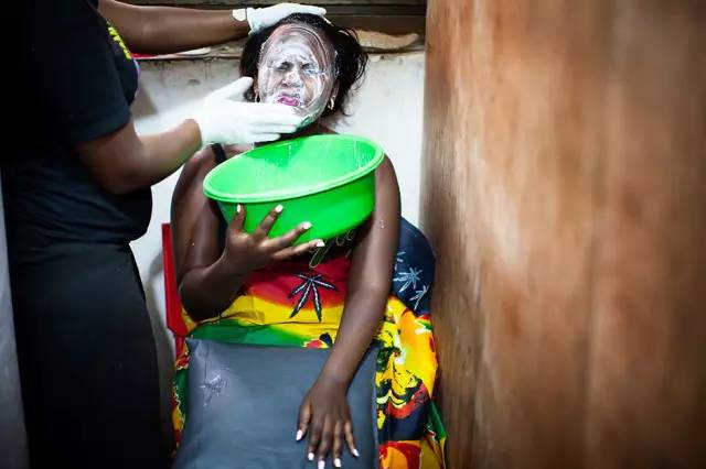 “我想变白，这样就会有更多男人来追我”