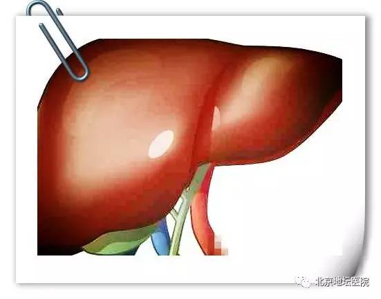 肝囊肿肝血管瘤肝内钙化灶,肝钙化血管瘤能治愈吗