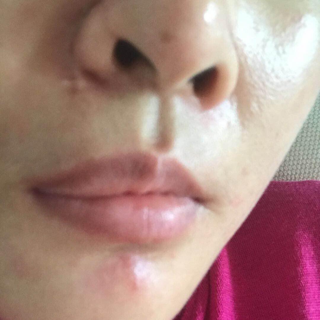 丽江被打毁容女游客视频,女游客丽江被打毁容案